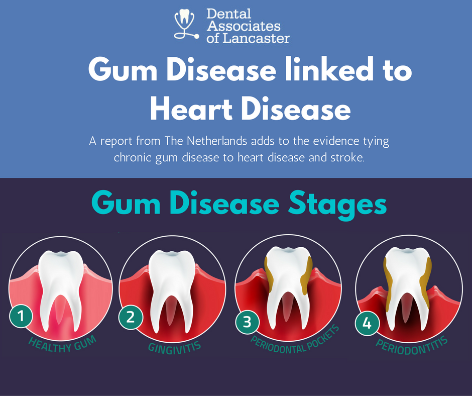 The Connection Between Gum Disease and Heart Health: A Growing Concern