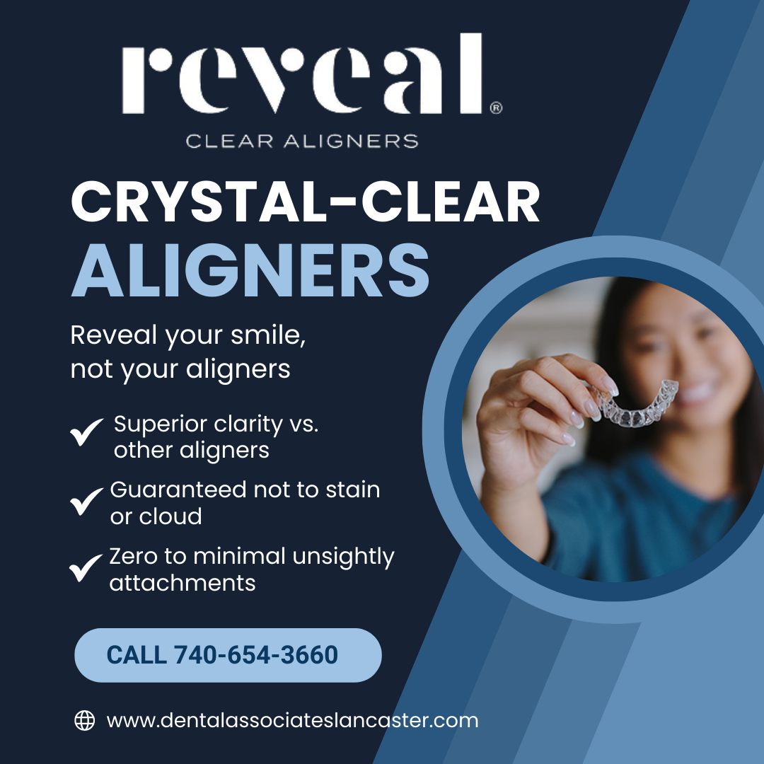 reveal ad for clear teeth aligners